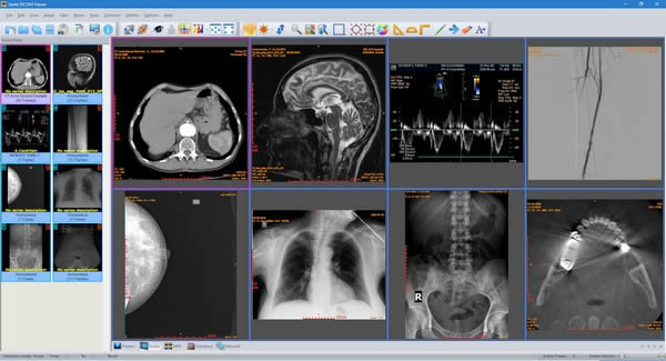 Sante DICOM Viewer-ҽư칫-Sante DICOM Viewer v11.8.6ٷ