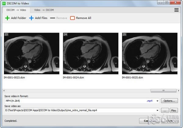 DICOM to Video-DICOMתƵ-DICOM to Video v1.12.0ٷ